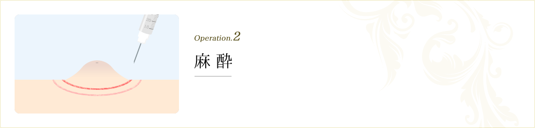 operation.2 麻酔