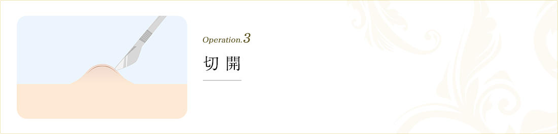operation.3 切開

