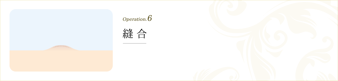 operation.6 縫合