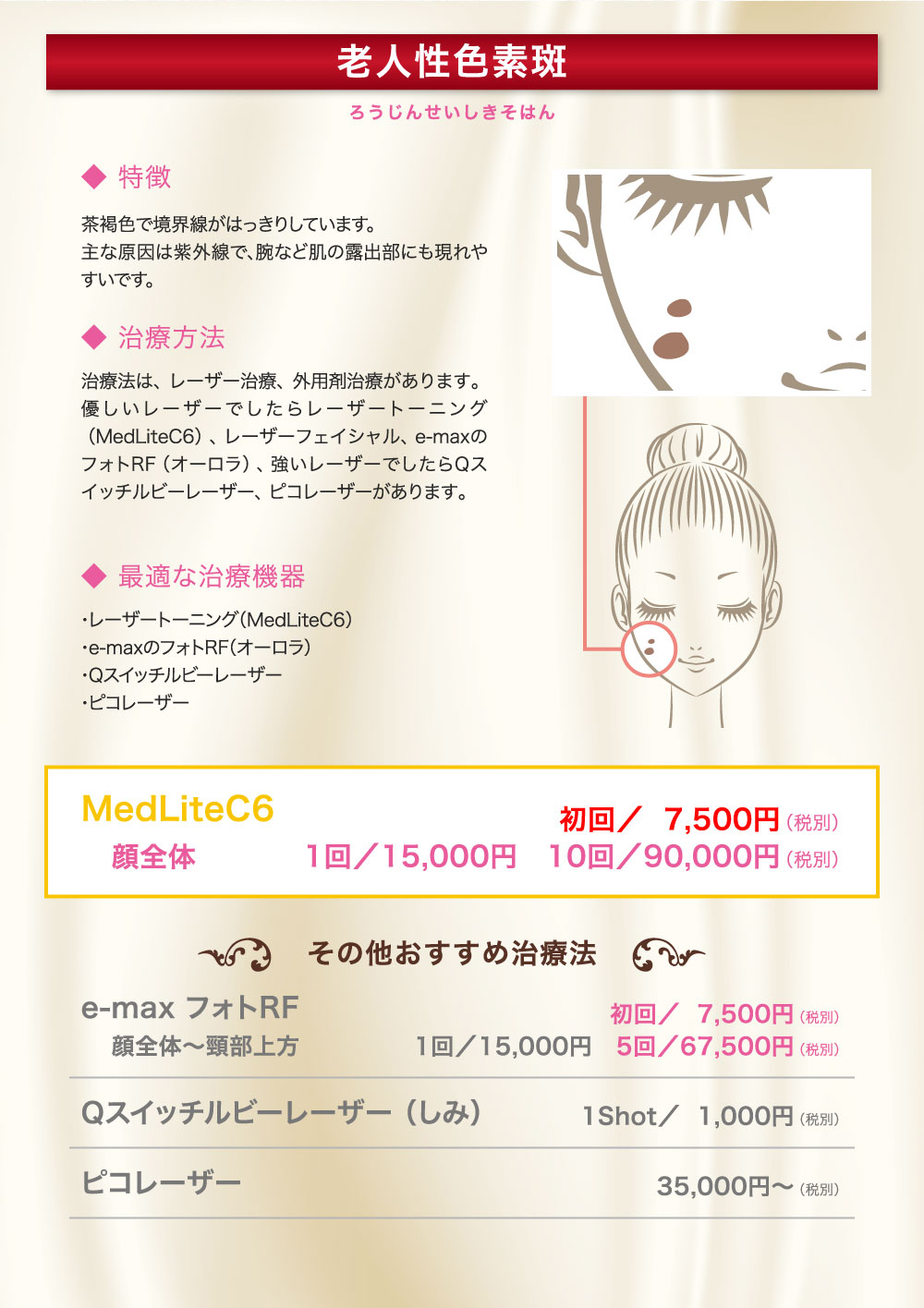 老人性色素斑