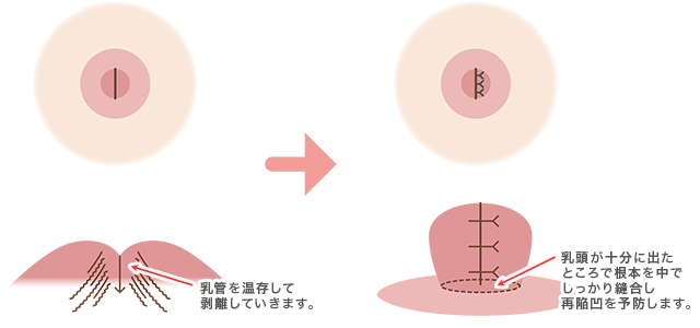 程度が軽い場合