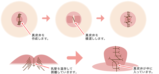 程度が強い場合