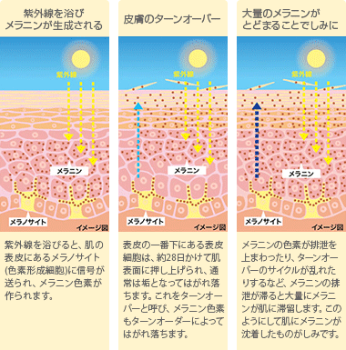 日光性のしみの解説図