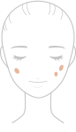 赤ら顔